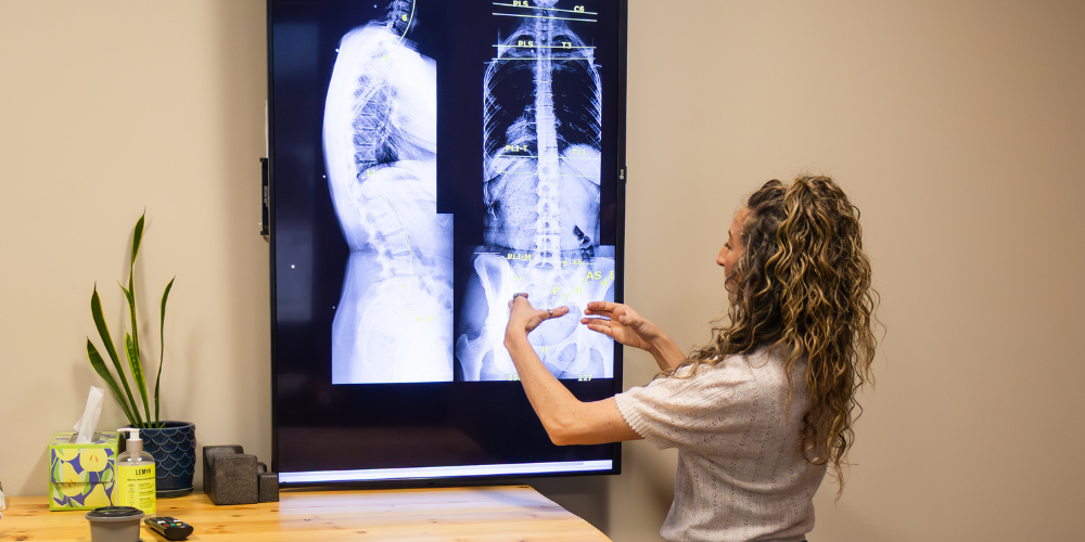 chiropractic xray West Des Moines